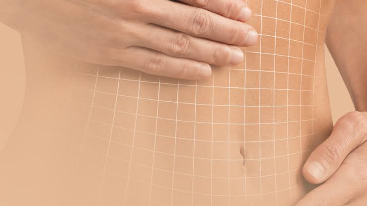 Addominoplastica in un centro estetico