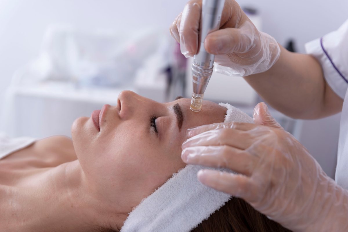 Microneedling estetico in un centro estetico