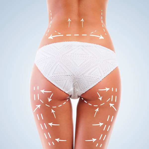 Rimodellamento glutei in un centro estetico